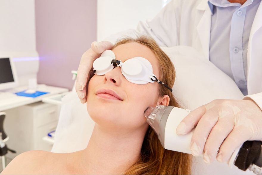 terapia laser cicatrici acne
